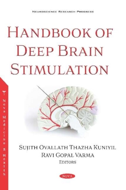 Handbook of Deep Brain Stimulation (Paperback)
