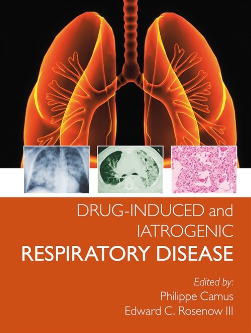 Drug-induced and Iatrogenic Respiratory Disease (Paperback, 1)