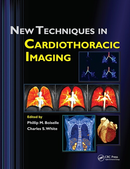 New Techniques in Cardiothoracic Imaging (Paperback, 1)