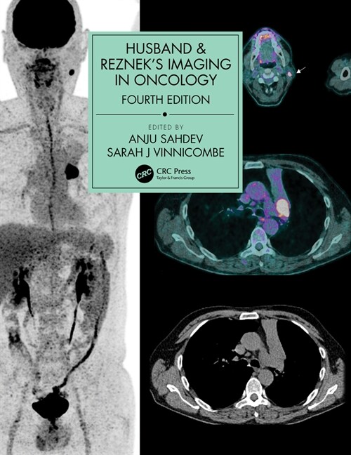 Husband & Rezneks Imaging in Oncology (Hardcover)