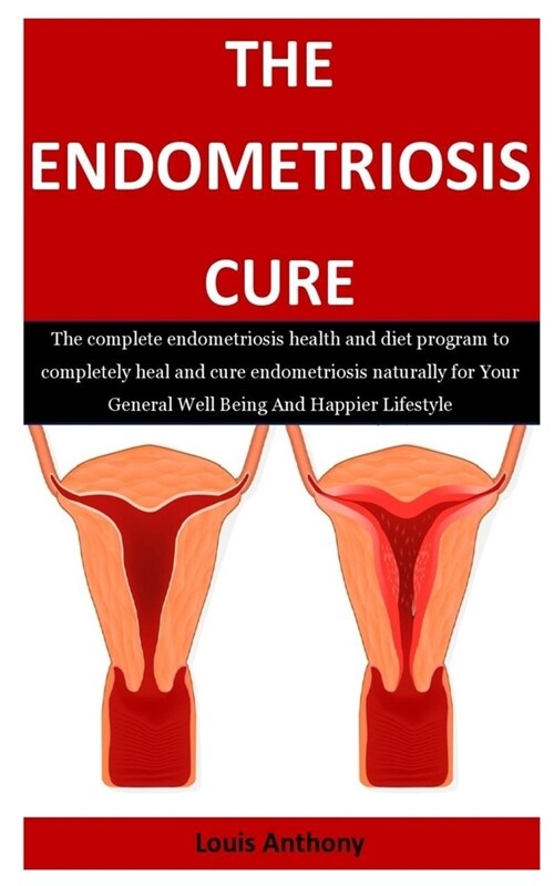 The Endometriosis Cure: The complete endometriosis health and diet program to completely heal and cure endometriosis naturally for Your Genera (Paperback)
