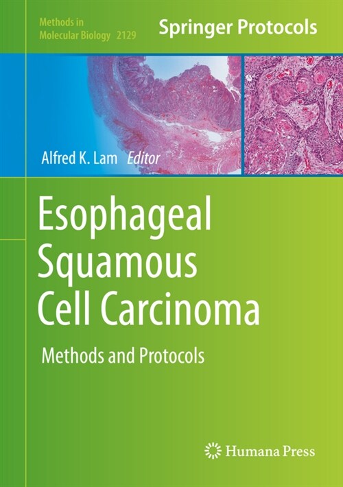 Esophageal Squamous Cell Carcinoma: Methods and Protocols (Hardcover, 2020)