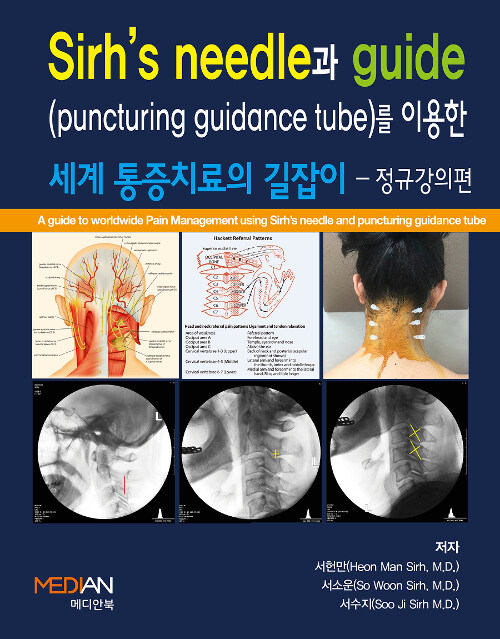 Sirhs needle과 guide(puncturing guidance tube)를 이용한 세계 통증치료의 길잡이 : 정규강의편