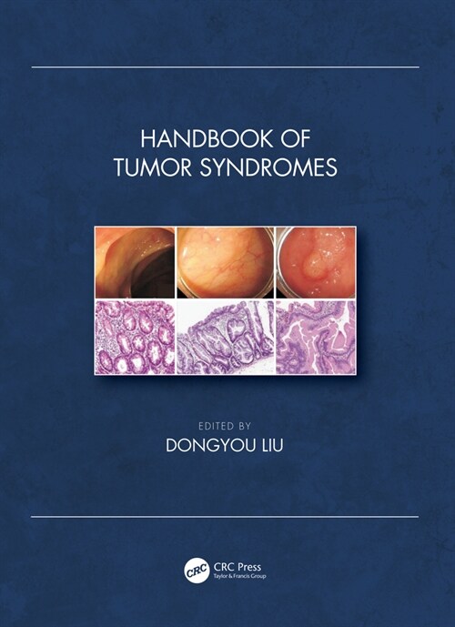Handbook of Tumor Syndromes (Hardcover, 1)