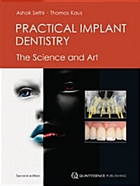 Practical Implant Dentistry (Hardcover, 2 Revised edition)