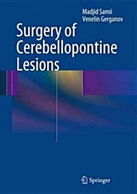 Surgery of Cerebellopontine Lesions (Hardcover, 2013)