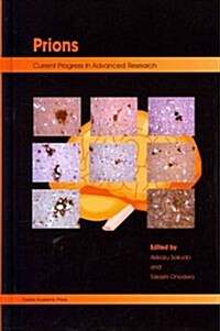 Prions: Current Progress in Advanced Research (Hardcover)