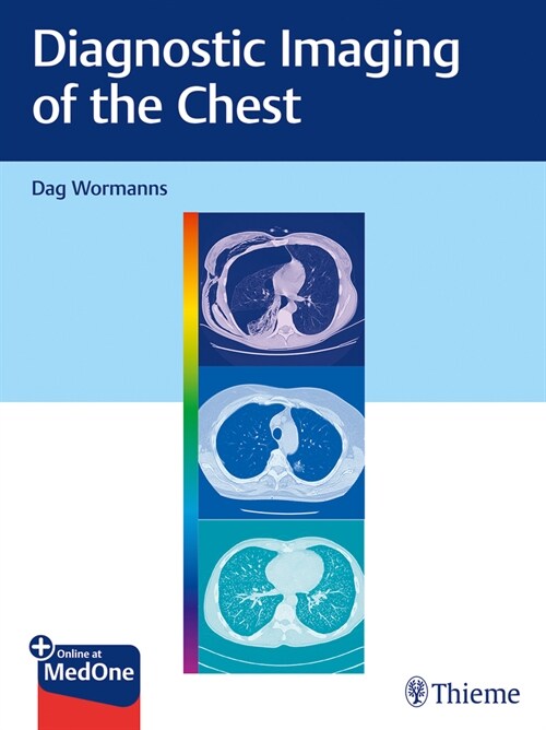 Diagnostic Imaging of the Chest (Hardcover)