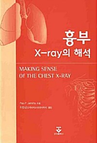 흉부 X-RAY의 해석