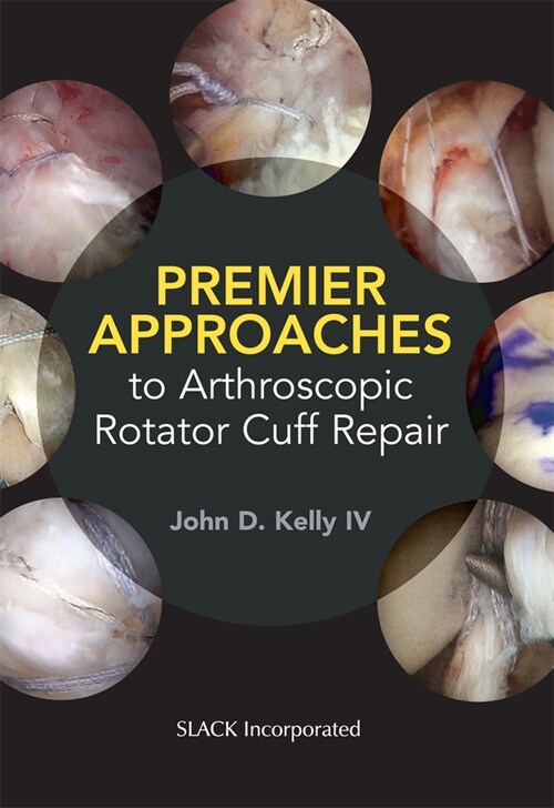 Premier Approaches to Arthroscopic Rotator Cuff Repair (Paperback)