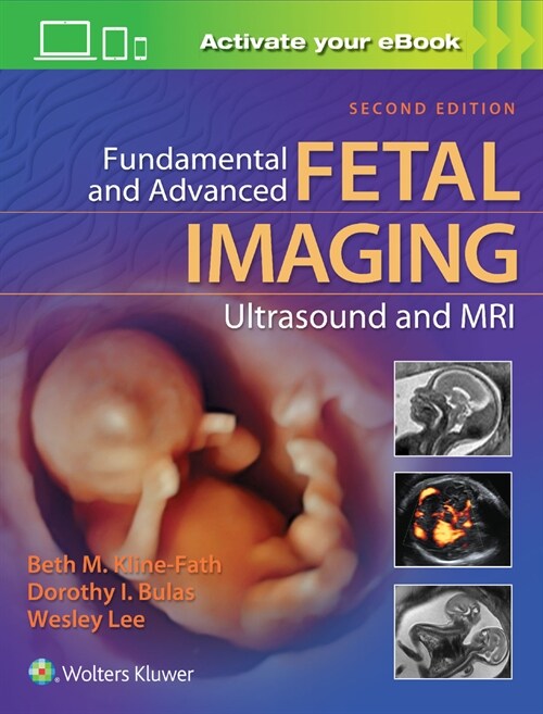 Fundamental and Advanced Fetal Imaging Ultrasound and MRI (Hardcover, 2)
