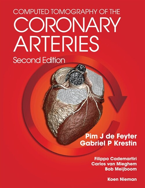 Computed Tomography of the Coronary Arteries (Paperback, 2 ed)