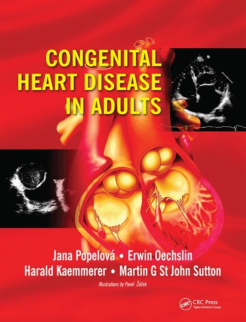 Congenital Heart Disease in Adults (Paperback, 1)