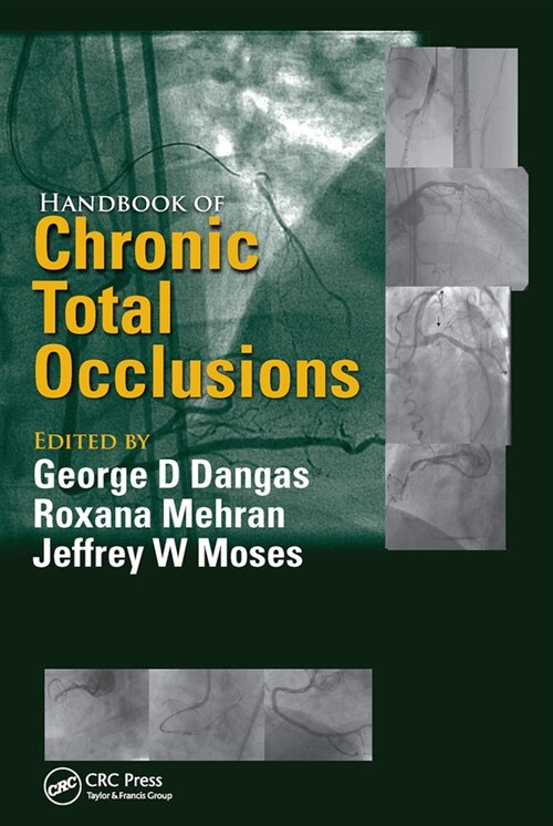 Handbook of Chronic Total Occlusions (Paperback, 1)