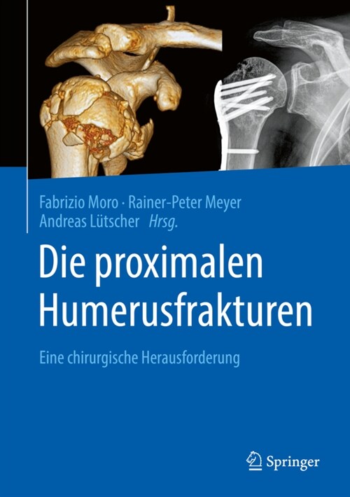 Die Proximalen Humerusfrakturen: Eine Chirurgische Herausforderung (Hardcover, 1. Aufl. 2020)