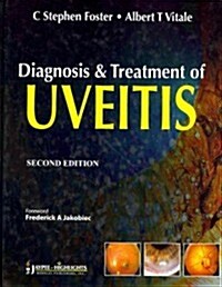 Diagnosis and Treatment of Uveitis (Hardcover, 2)