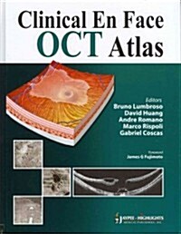 Clinical En Face OCT Atlas (Hardcover)
