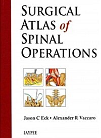 Surgical Atlas of Spinal Operations (Hardcover)