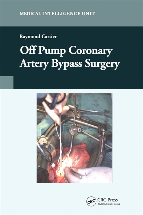 Off-Pump Coronary Artery Bypass Surgery (Paperback, 1)