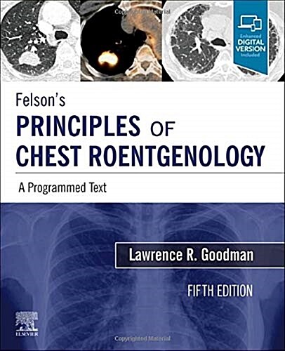 Felsons Principles of Chest Roentgenology, a Programmed Text: A Programmed Text (Paperback, 5)