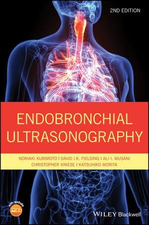 Endobronchial Ultrasonography (Hardcover, 2)