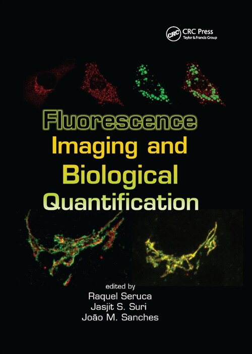 Fluorescence Imaging and Biological Quantification (Paperback)