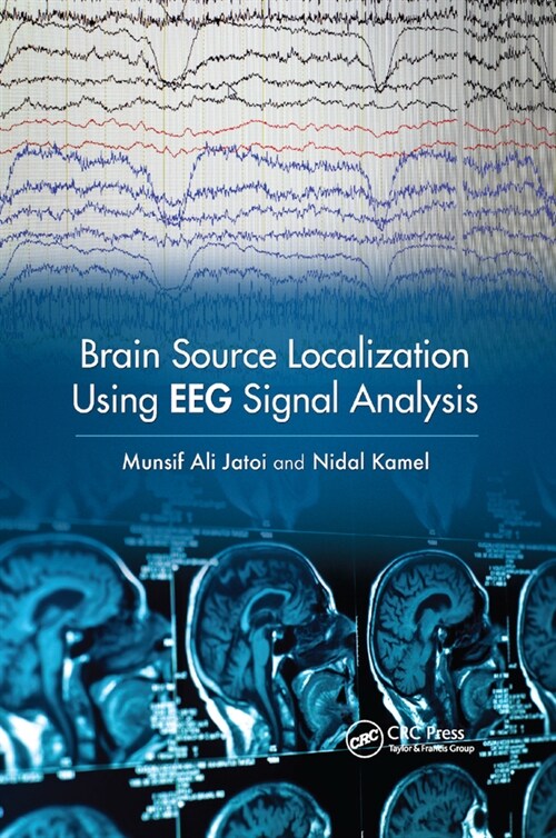 Brain Source Localization Using Eeg Signal Analysis (Paperback)