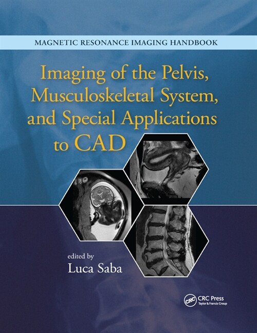 Imaging of the Pelvis, Musculoskeletal System, and Special Applications to CAD (Paperback)