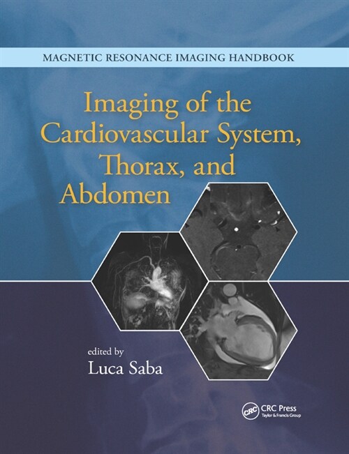 Imaging of the Cardiovascular System, Thorax, and Abdomen (Paperback)