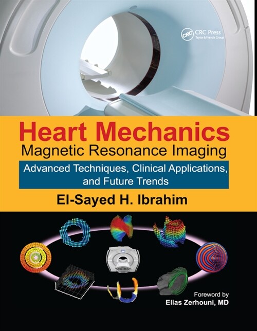 Heart Mechanics : Magnetic Resonance Imaging—Advanced Techniques, Clinical Applications, and Future Trends (Paperback)