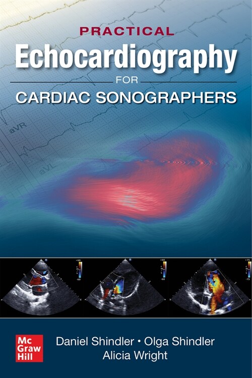 Practical Echocardiography for Cardiac Sonographers (Paperback)