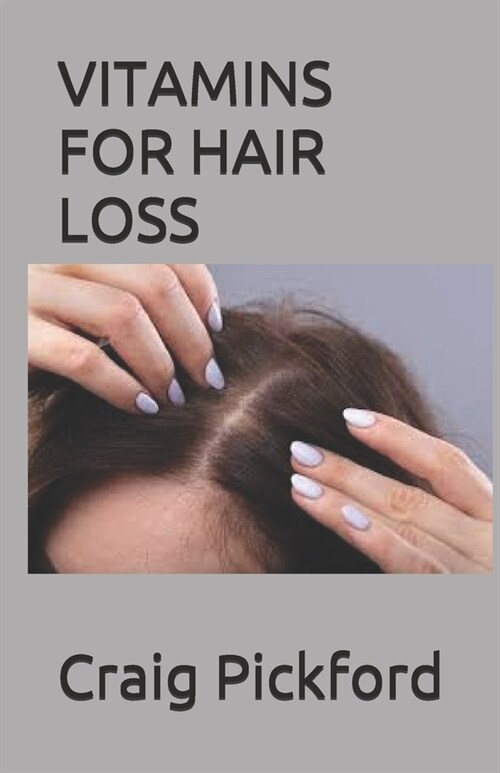 Vitamins for Hair Loss: A Perfect Guide With The Use Of Vitamins For Loosing Hair And Growing Faster (Paperback)
