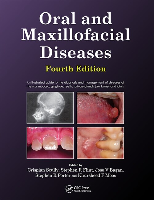 Oral and Maxillofacial Diseases, Fourth Edition (Paperback, 4 ed)