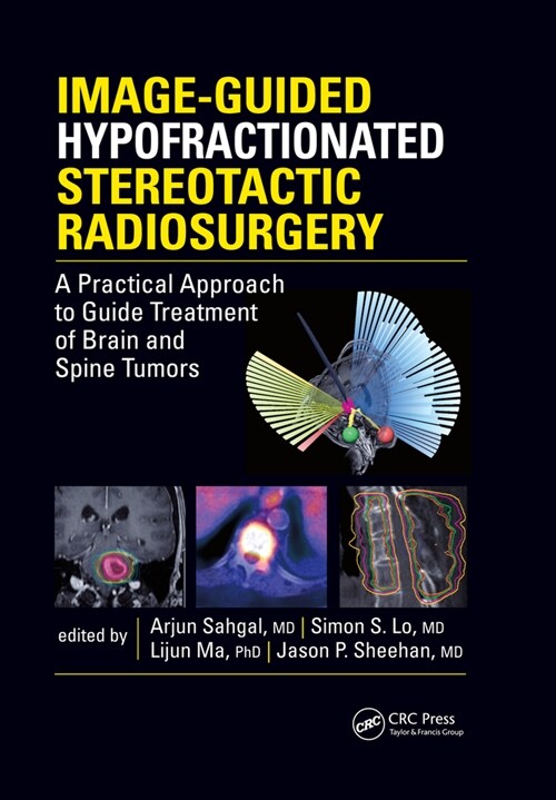 Image-Guided Hypofractionated Stereotactic Radiosurgery : A Practical Approach to Guide Treatment of Brain and Spine Tumors (Paperback)