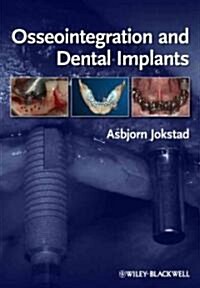 Osseointegration and Dental Implants (Hardcover)