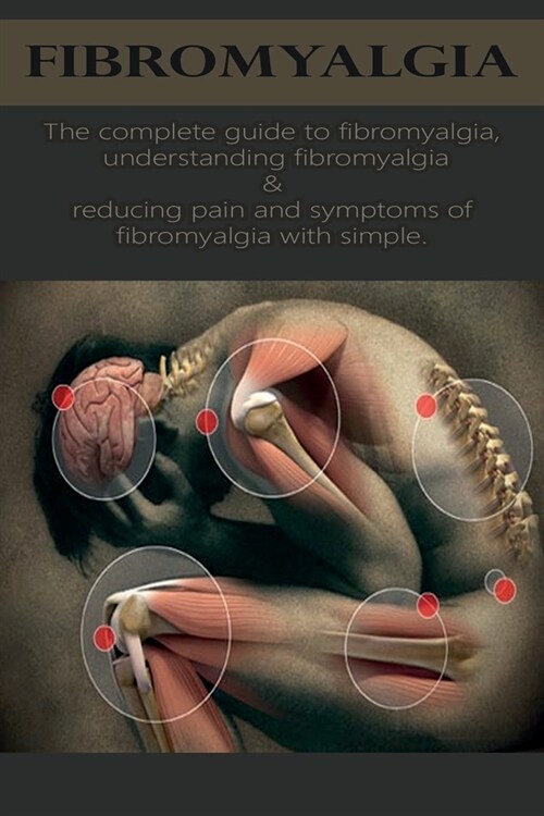 Fibromyalgia: The complete guide to fibromyalgia, understanding fibromyalgia, and reducing pain and symptoms of fibromyalgia with si (Paperback)