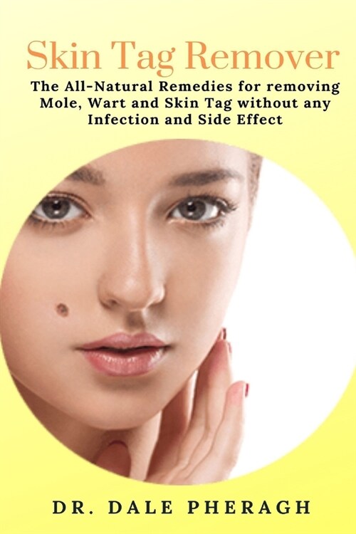 Skin Tag Remover: The All-Natural Remedies for removing Mole, Wart and Skin Tag without any Infection and Side Effect (Paperback)
