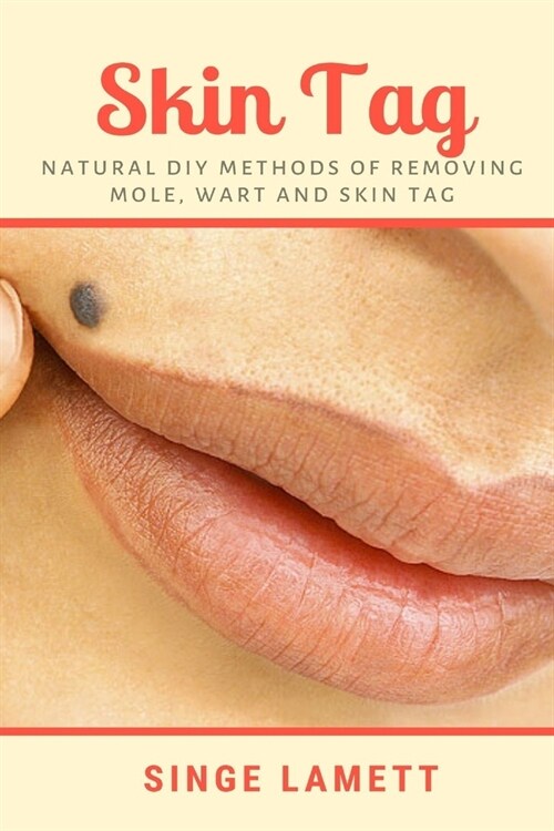 Skin Tag: Natural DIY Methods of removing Mole, Wart and Skin Tag (Paperback)