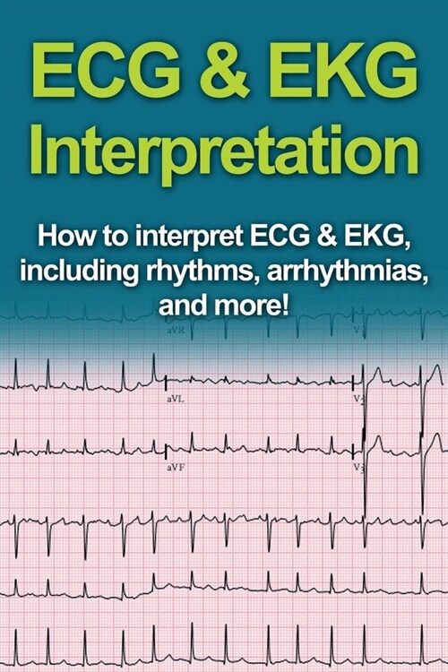 ECG & EKG Interpretation: How to interpret ECG & EKG, including rhythms, arrhythmias, and more! (Paperback)