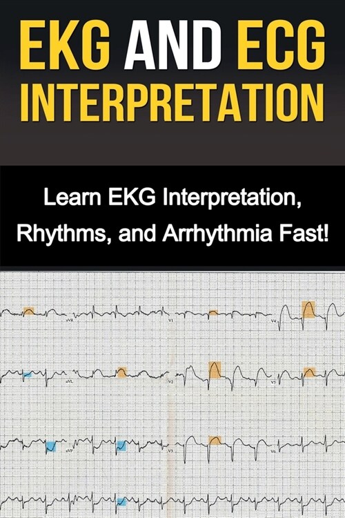 EKG and ECG Interpretation: Learn EKG Interpretation, Rhythms, and Arrhythmia Fast! (Paperback)