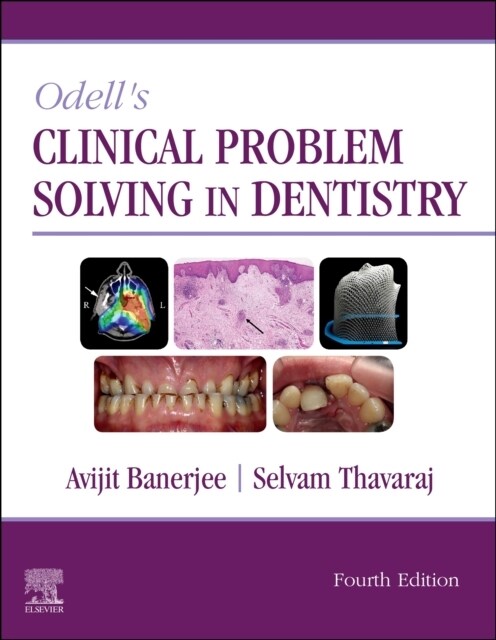 Odells Clinical Problem Solving in Dentistry (Paperback, 4 ed)