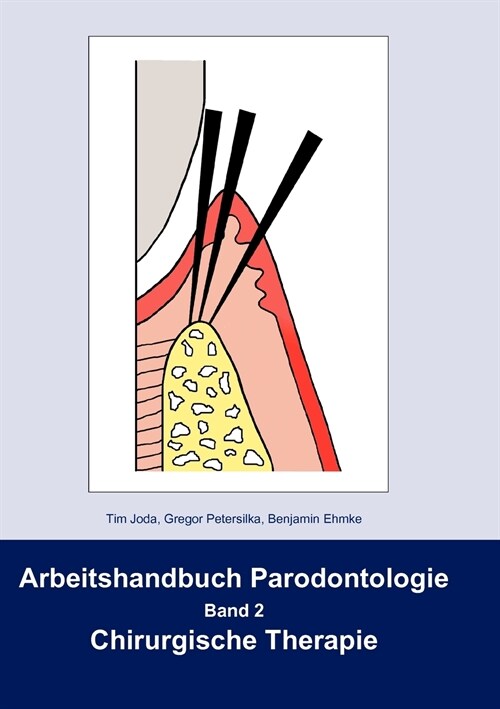 Arbeitshandbuch Parodontologie: Band 2 Chirurgische Therapie (Paperback)