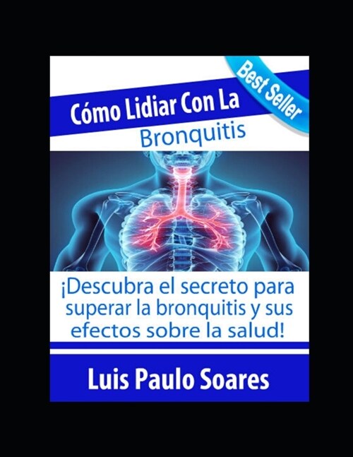 C?o lidiar con la bronquitis (Paperback)