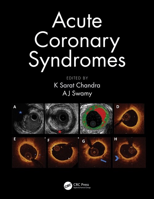 Acute Coronary Syndromes (Hardcover, 1)