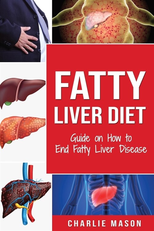Fatty Liver Diet: Guide on How to End Fatty Liver Disease Fatty Liver Diet Books: Fatty Liver Diet (fatty liver diet for fatty liver Boo (Paperback)