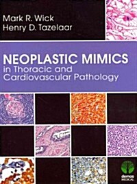 Neoplastic Mimics in Thoracic and Cardiovascular Pathology (Hardcover, 1st)