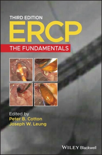 Ercp: The Fundamentals (Hardcover, 3)