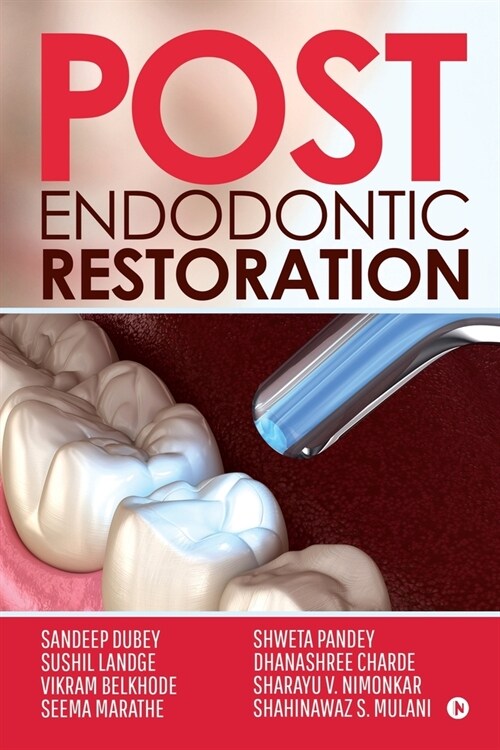 Post Endodontic Restoration (Paperback)