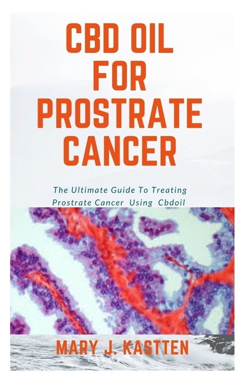 CBD Oil for Prostrate Cancer: The Ultimate Guide To Treating Prostrate Cancer Using Cbdoil (Paperback)