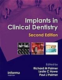Implants in Clinical Dentistry (Hardcover, 2 ed)